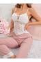 Lace Pajama Set with Color Options - 4