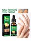 Nail Fungus Treatment Serum | Fast-Acting Formula for Healthy Nails - 8