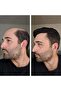 Men's Real Human Hair Toupee, Q6 Swiss Lace PU Base, Hair Loss Solution - 5