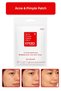 Acne Pimple Patch