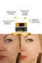 Skin Whitening, Anti-Blemish, Brightening and Tone Equalizing, Blemish Cream 50 ml