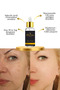 Anti-Blemish & Skin Tone Equalizing Brightening Skin Brightening Serum 30 ml