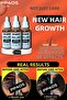 Professional Hair Remover Care Serum - Root Builder and Intense Thickener 3 Pieces