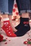 2Pair Nose Stitch-Free February 14 Valentine's Day Socks Set 1 Female 1 Male - 2