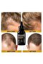 5% Minoxidil Serum for Men Women, 60ml - 3