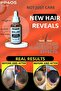Professional Hair Remover Care Serum - Root Builder and Intense Thickener 3 Pieces - 4