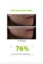 Sebium Serum Help Prevent Acne, Acne Spot Anti-Aging Salicylic Acid 30 ml - 2