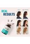 Live Conscious Clinical Formula Hair Growth Vitamins for Women and Men w/Biotin, Collage - 3