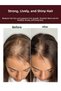 Salt-Free Garlic Shampoo That Helps Fast Growth and Prevents Hair Loss, Biotin Anti-Hair Loss 500 ml - 5