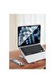 حامل كمبيوتر محمول قابل للطي من الألومنيوم عالي الجودة، متوافق مع أجهزة iPad وMacbook - 6