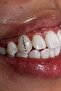 Make Your Own Design Tooth Diamond Set (20-Piece Design Set Made from Austrian Crystals) - 6