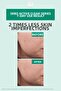 Anti-Imperfection, Moisturizing and Mattifying Cream for Acne-Prone Skin 40 ml - 4