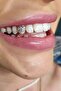 Make Your Own Design Tooth Diamond Set (20-Piece Design Set Made from Austrian Crystals) - 5