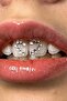 Make Your Own Design Tooth Diamond Set (20-Piece Design Set Made from Austrian Crystals) - 4