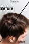 Anti-Dandruff Effective Nettle Extract 600 ml Care Shampoo Nettle Shampoo Salt-Free Shampoo - 3