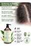 Scalp Balance Anti-Dandruff Shampoo 1000 ml |   Effective Care Against Dandruff |   Balanced Scalp - 3