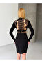 Black Lace Detail Backless Mini Dress with Suyolu - 5