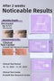 Retinol Peptide Lifting Pad Anti-Aging Korean Tonic Pad 12 Pieces - 3