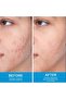 Expigment 4% Cream – Fade Age Spots, Melasma & Acne Scars (20g) - 3