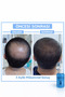 Men's Hair Serum, Hair Serum, Hair Booming (3 Serum Combs Gift) - 8