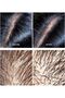 C.TOX Blooming Pro Scaler 200ml – Scalp Exfoliating Treatment for Deep Cleansing, Oil & Dandruff C - 5