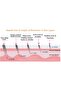 Derma Roller Face Scalp Cosmetic Micro Needle Skin Care Beauty 1.0mm 540 Titanium Reus - 4