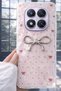 Redmi Note 14 Pro Plus Case with Camera Protrusion, Shiny Figure, Shiny Happy Silicone Cover