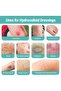 Hydrocolloid Roll for Wound Care & Acne Treatment (5cm x 2m) - 3