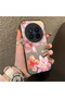 Vivo X300 Pro Compatible Hard Acrylic Back Silicone Edge Lens Protection Case Lily Pattern - 2
