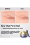 Vital Perfection Eye Contour and Skin Care Set Containing Retinol and Lifting Effect - 2