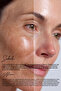 Anti-Blemish Care Serum - 30ml - 4