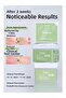 Tea Tree Anti-Blackhead Tonic Pad 12 Pieces Sebum Control Soothing Skin Care Pad - 3