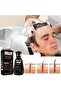 Biotin Hair Growth Shampoo DHT Blocker Solution for Hair Fall Control, Deep Nourishing Scal - 3