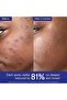 Vinoperfect Anti-Blemish and Radiance Serum 30 ml - 5