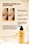 Slim Gel (Slim Gel) Cellulite Gel and Stretch Mark Cream & Stretch Mark Set to Help Reduce Stretch Marks - 5