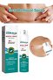 Medical Grade Scar Spray, Reduce Scars and Smooth Skin 20g