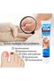 Nail Fungus Treatment Cream, Bad Nail Care Ointment, Nail Fungus Treatment, Nail Growth and Repair - 5