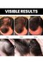 Batana Oil for Hair Growth, For Healthy Hair, Batana Oil for Men and Women - 2