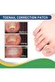 50-Piece Box Toenail Corrector Patch, Nail Care Patch - 2