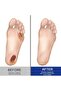Diabetic’s Foot Cream 20g–Intensive Moisturizing & Repair Cream for Dry, Itching, Cracked Heels - 6