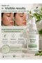 Anti-Acne Serum, Salicylic Acid, Niacinamide, Hyaluronic Acid Tea Tree Oil Skin Serum 30 ml - 3
