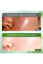 Aloe Vera Skincare 6 pcs Set suitable for all skin types - 3