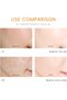California Vitamin C Serum with Hyaluronic Acid for Face, Anti Aging & Dark Spot Remover - 3