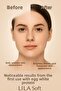 Egg White Mask Egg White Mask Removes Blemishes, Blackheads and Tightens Pores - 7