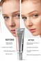 Pdrn Brightening Moisturizing Facial Blemish Cream, Anti-Aging and Anti-Wrinkle, Salmon Dna 30ml - 6