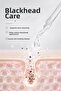 10% Niacinamide Serum |   1% Zinc Pca & 1% Tranexamic Acid |   Balancing Care for Pore and Blackhead Appearance - 5