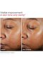 UV Clear Facial Sunscreen SPF 46 - For Skin Types Prone To Acne, Rosacea & Hyperpigmentation - 8