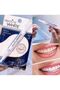 Practical Teeth Whitening Pen - Instant Whitening Effect - 2