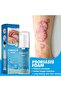 Psoriasis Foam 50Ml Treatment - 3