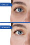 Under Eye Circle Dark Circle Wrinkle Bag Darkening Swelling Dark Circle Moisturizing Cream 2 Pieces - 7